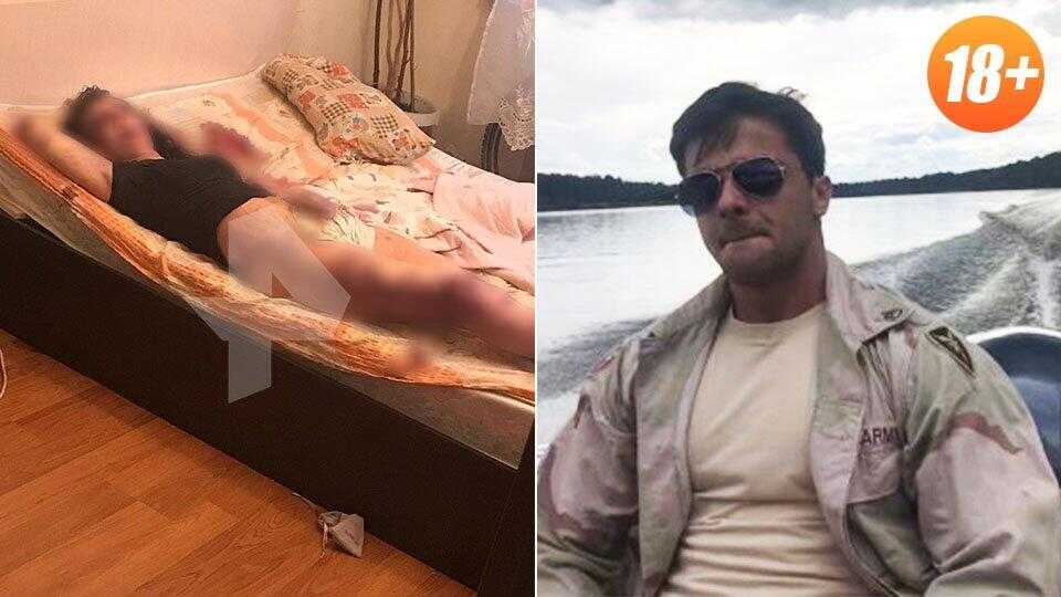 Почему у хоакина феникса шрам на верхней губе